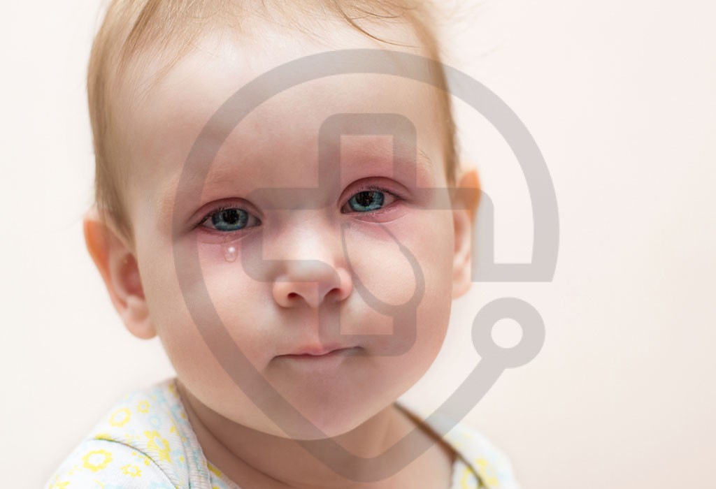 عفونت چشم در نوزاد